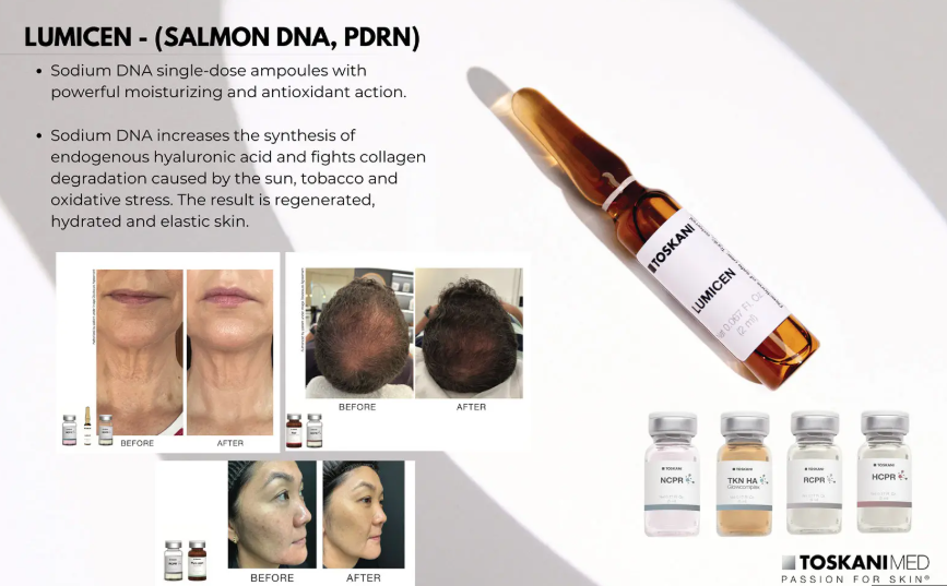 PDRN SALMON DNA SALMON SPERM ATLANTA GA